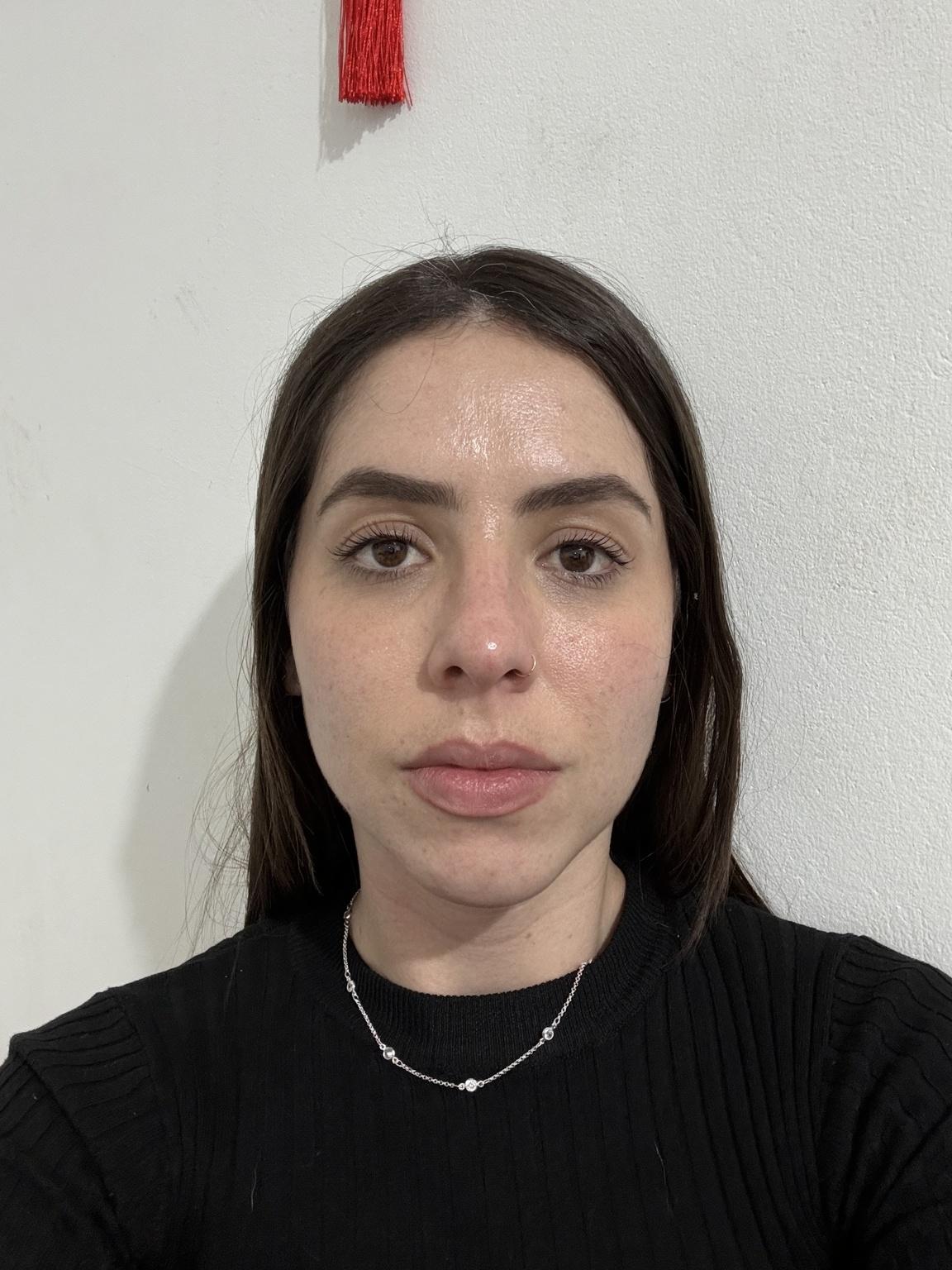 do-a-facial-harmonization-1-lyuqz0cklc