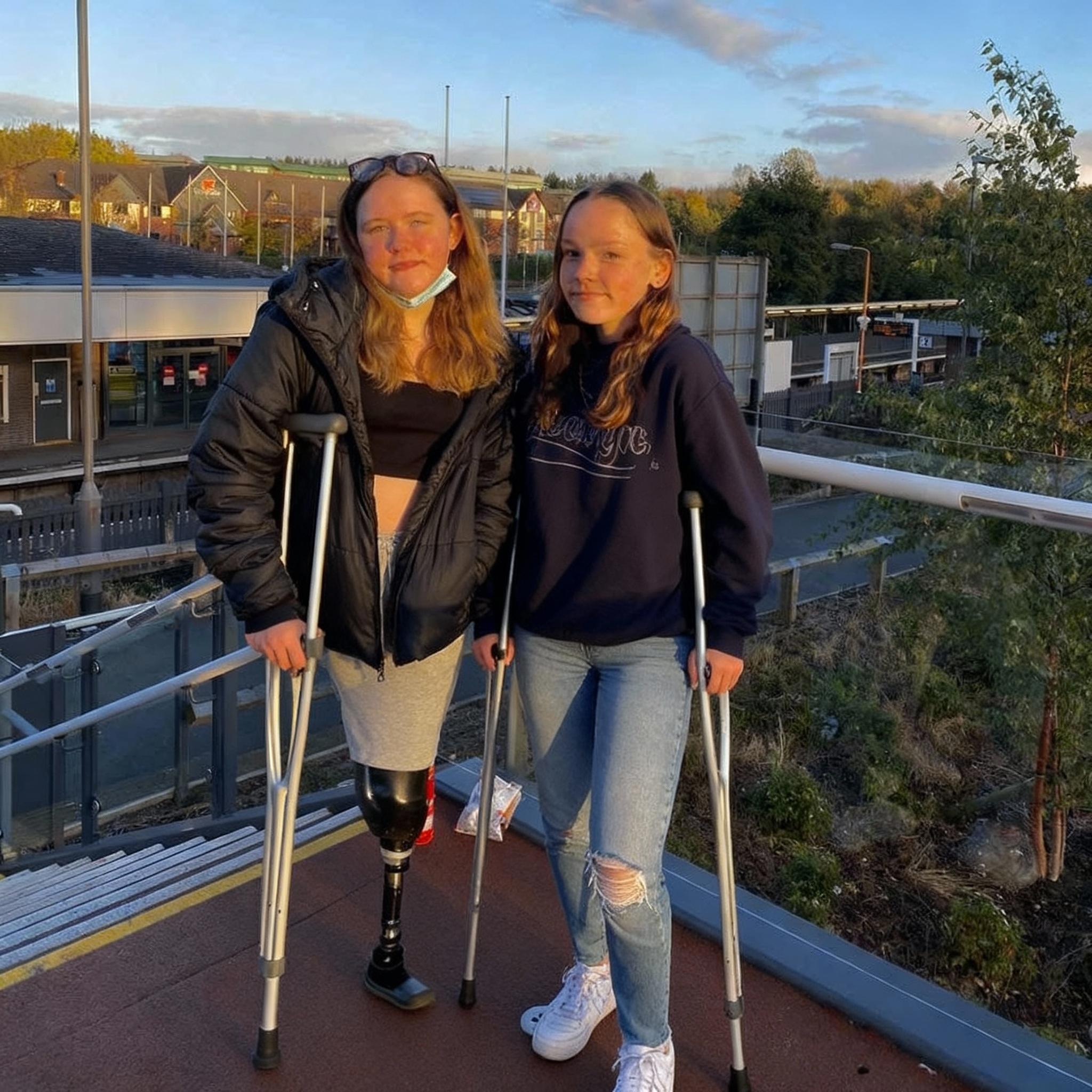 make-both-leg-amputees-with-no-prosthetics-on-wjvw4xuesl