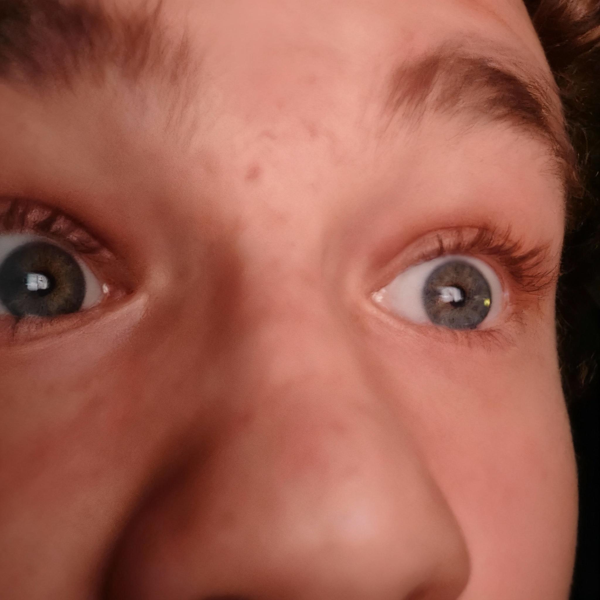 make-my-pupils-very-small-pvtvekcdcu