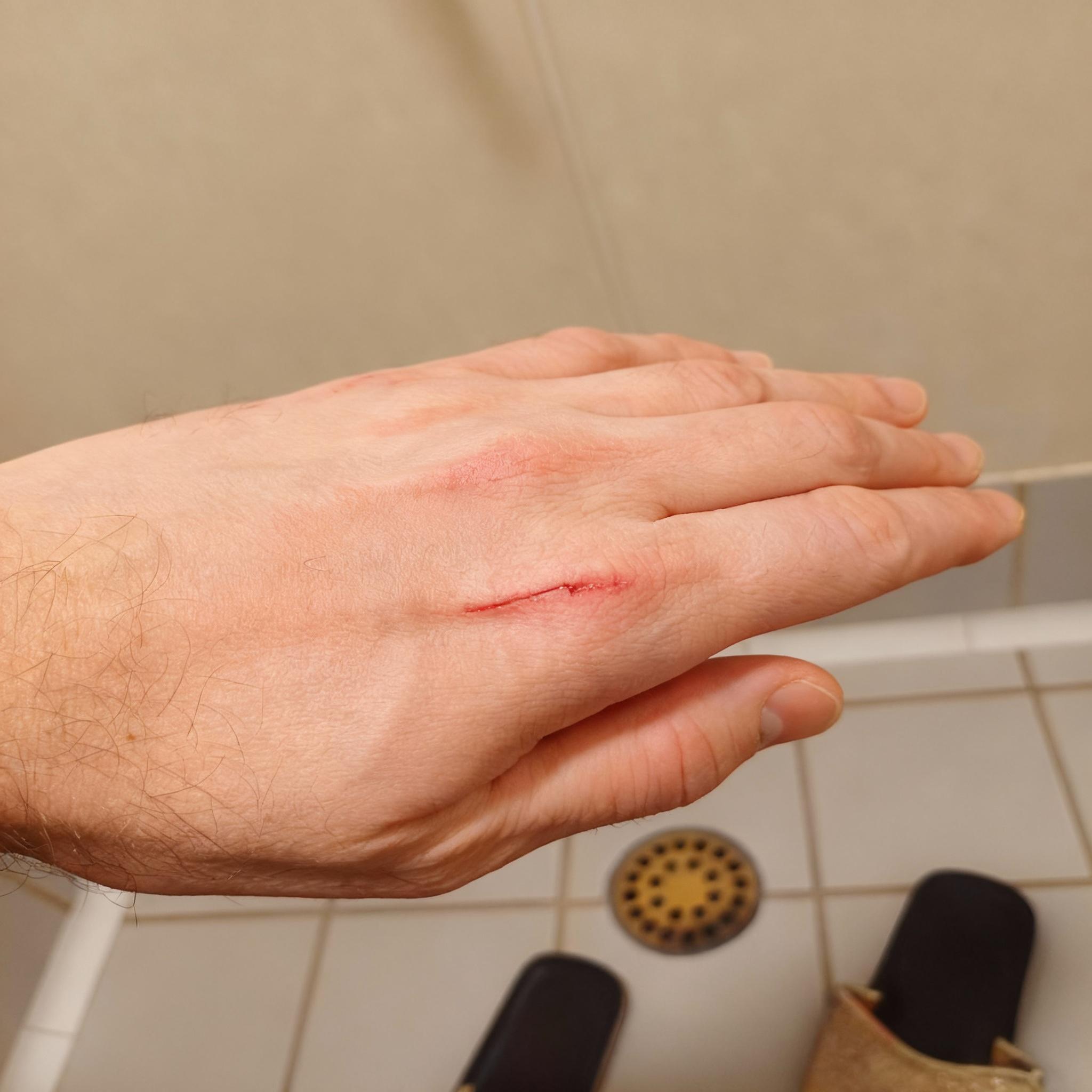 dodaj-przeciecie-na-dloni-h5t2qsiop4